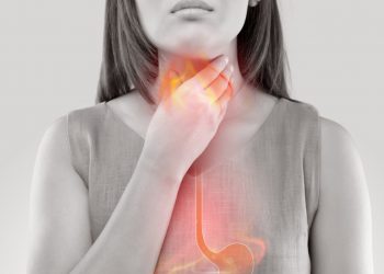 Common Causes of Heartburn and How to Treat It